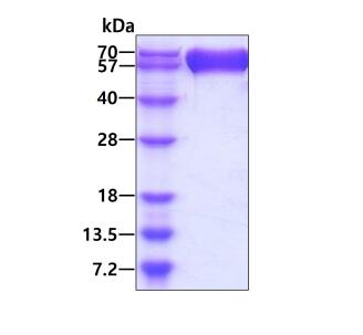 3 μg by SDS-PAGE under reducing condition and visualized by coomassie blue stain